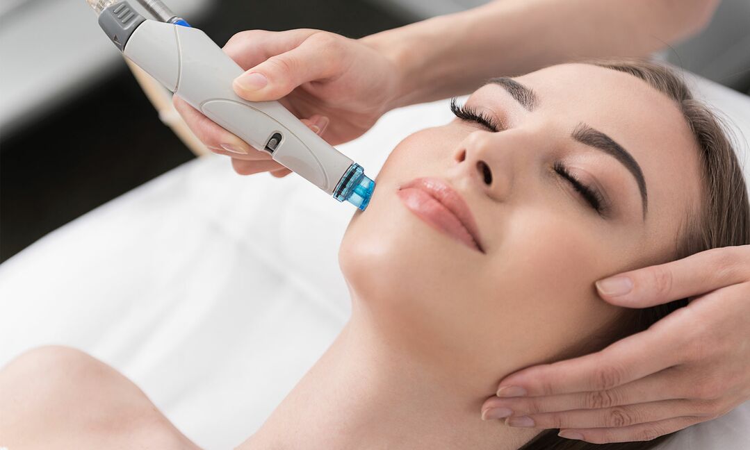 HydraFacial – clean, extract and hydrate the skin